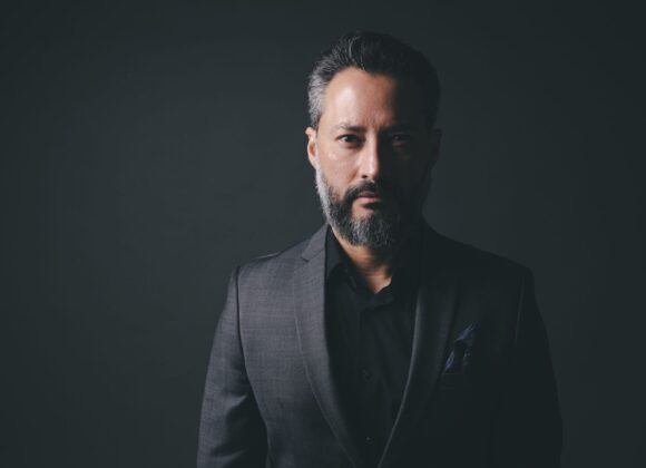 Calvície masculina: quais os sinais de alerta? Calvície masculina: quais os sinais de alerta?